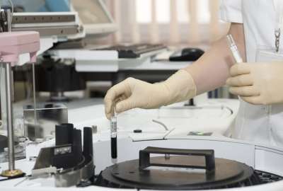 OMS publica la loista de enfermedades que m&aacute;s atenci&oacute;n recibir&aacute;n por parte de la ciencia