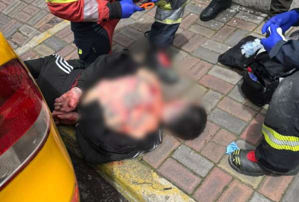 Polic&iacute;a Nacional neutraliz&oacute; a presunto agresor, tras ataque a una mujer