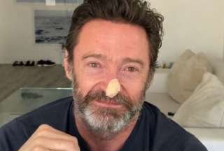 Hugh Jackman, protagonista de Wolverine, no tiene c&aacute;ncer de piel&nbsp;