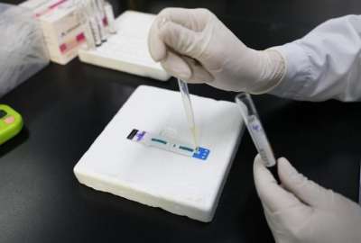 China apuesta por la prevenci&oacute;n del VIH/Sida. 