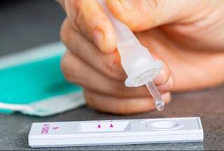 Reportan el primer caso de infecci&oacute;n simult&aacute;nea de covid-19, viruela del mono y VIH