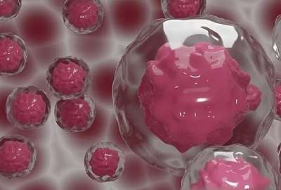 Medicamento en fase de pruebas fren&oacute; el c&aacute;ncer de col&oacute;n