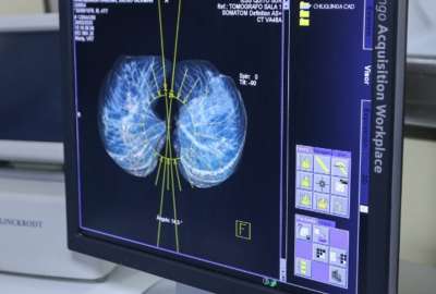 Inspi analiza casos de posible BA.2 de &Oacute;micron en Ecuador