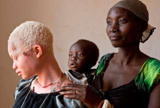 Al menos 11 muertos en una protesta por el ataque a un ni&ntilde;o albino en Madagascar