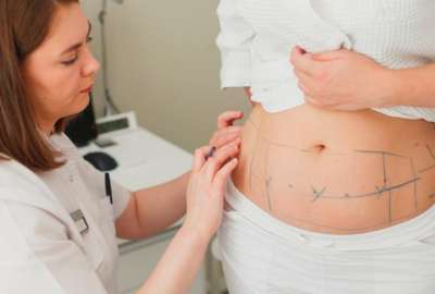 Estaf&oacute; a su familia para conseguir dinero y hacerse una liposucci&oacute;n