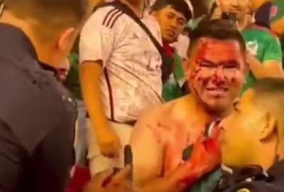 El video del hincha agredido se volvi&oacute; viral