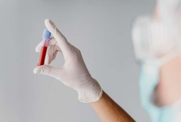 Mujer espa&ntilde;ola se cur&oacute; de forma 'funcional' del VIH