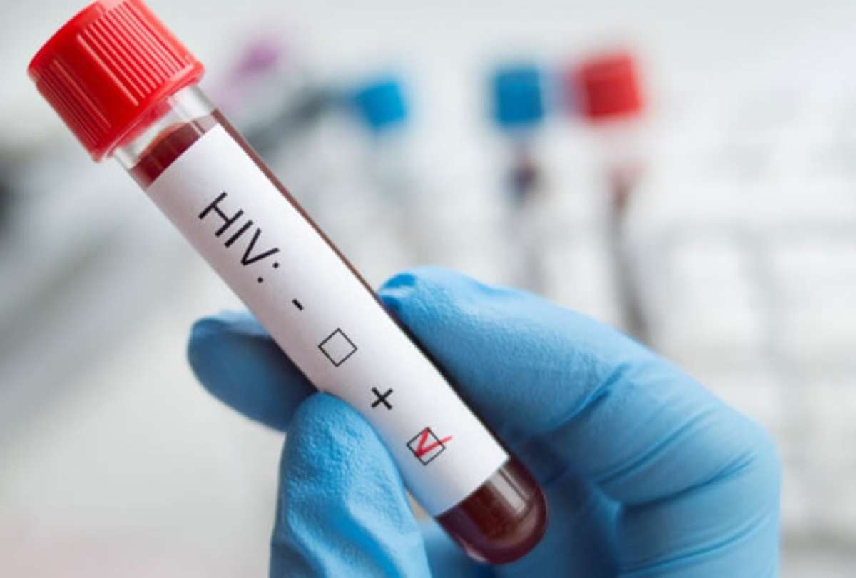 Tercera paciente curado de VIH